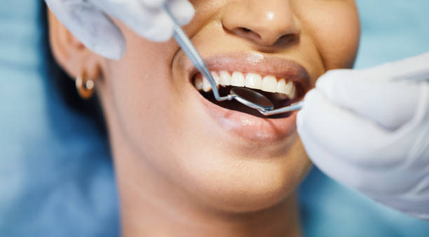Best Chipped Tooth Repair Near Me  in Ogden Dunes, IN